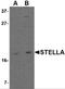 Developmental Pluripotency Associated 3 antibody, 4755, ProSci, Western Blot image 