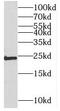 Methyltransferase Like 5 antibody, FNab05141, FineTest, Western Blot image 