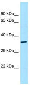 Casein Kinase 1 Alpha 1 antibody, TA339969, Origene, Western Blot image 