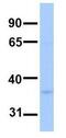 Phospholipid Phosphatase Related 2 antibody, GTX46008, GeneTex, Western Blot image 