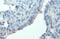Protein Tyrosine Kinase 2 antibody, GTX132140, GeneTex, Immunohistochemistry paraffin image 