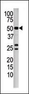 Protein Phosphatase 3 Catalytic Subunit Beta antibody, MBS9207436, MyBioSource, Western Blot image 