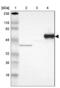 Serpin Family A Member 7 antibody, NBP1-86963, Novus Biologicals, Western Blot image 