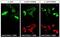 Stathmin-2 antibody, PA5-23049, Invitrogen Antibodies, Immunofluorescence image 