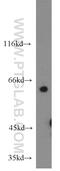 CDKN2A Interacting Protein antibody, 16615-1-AP, Proteintech Group, Western Blot image 