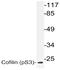 Cofilin 1 antibody, AP20808PU-N, Origene, Western Blot image 