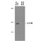 Interleukin-17 receptor B antibody, PA5-47051, Invitrogen Antibodies, Western Blot image 