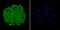 Nucleoporin 153 antibody, NBP2-75598, Novus Biologicals, Immunocytochemistry image 