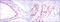 SUZ12 Polycomb Repressive Complex 2 Subunit antibody, STJ98405, St John