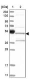 SH3 Domain Containing GRB2 Like, Endophilin B2 antibody, NBP1-81367, Novus Biologicals, Western Blot image 