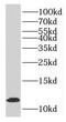 Myotrophin antibody, FNab05419, FineTest, Western Blot image 