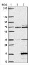 Alpha Hemoglobin Stabilizing Protein antibody, NBP1-84008, Novus Biologicals, Western Blot image 