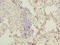 O-Linked N-Acetylglucosamine (GlcNAc) Transferase antibody, LS-C370075, Lifespan Biosciences, Immunohistochemistry paraffin image 