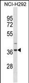 Zinc Finger Protein 696 antibody, PA5-49219, Invitrogen Antibodies, Western Blot image 