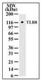 Toll Like Receptor 8 antibody, AM08388PU-N, Origene, Western Blot image 