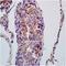 Pyruvate Dehydrogenase E1 Alpha 1 Subunit antibody, orb6670, Biorbyt, Immunohistochemistry paraffin image 