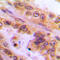 Histone Deacetylase 8 antibody, LS-C356088, Lifespan Biosciences, Immunohistochemistry paraffin image 