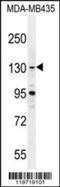 BRD4 Interacting Chromatin Remodeling Complex Associated Protein antibody, 55-710, ProSci, Western Blot image 