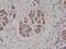 S100 Calcium Binding Protein B antibody, M00979-2, Boster Biological Technology, Immunohistochemistry paraffin image 