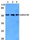 Gamma-Aminobutyric Acid Type A Receptor Delta Subunit antibody, PA5-75464, Invitrogen Antibodies, Western Blot image 