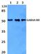 Gamma-Aminobutyric Acid Type A Receptor Delta Subunit antibody, PA5-75464, Invitrogen Antibodies, Western Blot image 