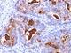 Carcinoembryonic Antigen Related Cell Adhesion Molecule 5 antibody, V2444IHC-7ML, NSJ Bioreagents, Immunohistochemistry paraffin image 