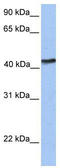 IGF Like Family Receptor 1 antibody, TA338667, Origene, Western Blot image 