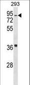 HIRA Interacting Protein 3 antibody, LS-C159836, Lifespan Biosciences, Western Blot image 