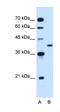 Glutamic-Oxaloacetic Transaminase 2 antibody, orb330306, Biorbyt, Western Blot image 