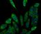 Kinesin Family Member 11 antibody, NBP2-76927, Novus Biologicals, Immunocytochemistry image 