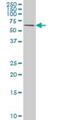 Receptor Interacting Serine/Threonine Kinase 2 antibody, H00008767-M05, Novus Biologicals, Western Blot image 