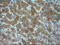 Actinin Alpha 1 antibody, M02635-1, Boster Biological Technology, Immunohistochemistry paraffin image 