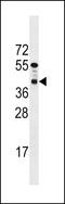 PTC7 Protein Phosphatase Homolog antibody, LS-C158720, Lifespan Biosciences, Western Blot image 