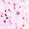 Tumor Protein P73 antibody, GTX32277, GeneTex, Immunohistochemistry paraffin image 
