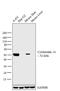 Keratin 14 antibody, MA5-11596, Invitrogen Antibodies, Western Blot image 