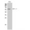 Chaperonin Containing TCP1 Subunit 8 antibody, LS-C386358, Lifespan Biosciences, Western Blot image 