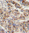 Enoyl-CoA Hydratase And 3-Hydroxyacyl CoA Dehydrogenase antibody, A05757-3, Boster Biological Technology, Immunohistochemistry paraffin image 