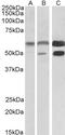 Calcium/Calmodulin Dependent Protein Kinase II Alpha antibody, LS-B4390, Lifespan Biosciences, Western Blot image 