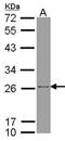 ATP Synthase Peripheral Stalk-Membrane Subunit B antibody, NBP1-33465, Novus Biologicals, Western Blot image 