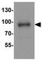 Phosphofurin Acidic Cluster Sorting Protein 2 antibody, GTX17244, GeneTex, Western Blot image 