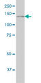 Phospholipase C Gamma 1 antibody, LS-C197919, Lifespan Biosciences, Western Blot image 