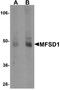 Major Facilitator Superfamily Domain Containing 1 antibody, NBP1-76488, Novus Biologicals, Western Blot image 