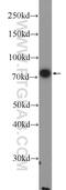 Collagen Beta(1-O)Galactosyltransferase 1 antibody, 16768-1-AP, Proteintech Group, Western Blot image 