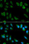 Interleukin 1 Receptor Antagonist antibody, STJ24179, St John