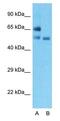 Solute Carrier Family 2 Member 2 antibody, GTX47126, GeneTex, Western Blot image 