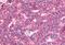 Adhesion G Protein-Coupled Receptor G6 antibody, MBS244608, MyBioSource, Immunohistochemistry paraffin image 