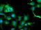 Tubulin Alpha Like 3 antibody, MA5-25778, Invitrogen Antibodies, Immunocytochemistry image 