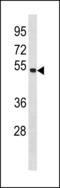 Sperm Associated Antigen 6 antibody, LS-C203878, Lifespan Biosciences, Western Blot image 