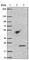 Transmembrane Protein 69 antibody, HPA026993, Atlas Antibodies, Western Blot image 