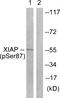 X-Linked Inhibitor Of Apoptosis antibody, PA5-38349, Invitrogen Antibodies, Western Blot image 